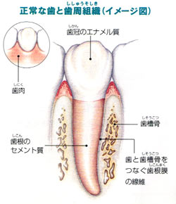 正常な歯と歯周組織